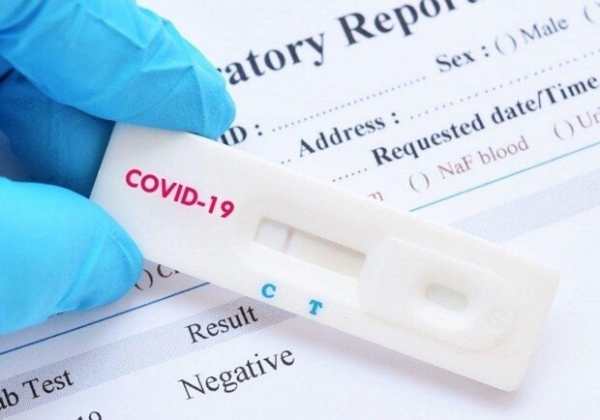 Какая статистика Covid-19 в Одесской области сегодня